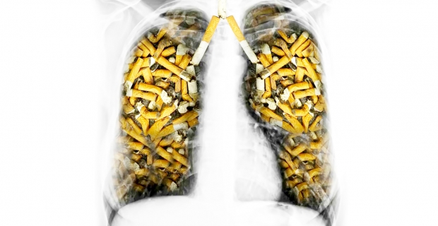 Sigara içmek pankreas kanseri riskini ikiye katlıyor