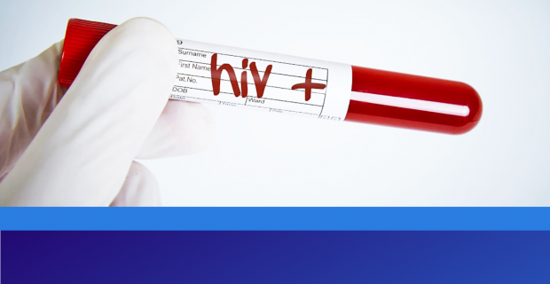 HIV tanısı alan kişilerin sayısı 10 bine ulaştı