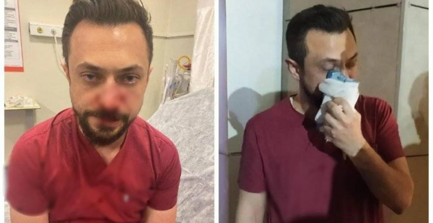 Urfa'da hasta yakınından doktora saldırı